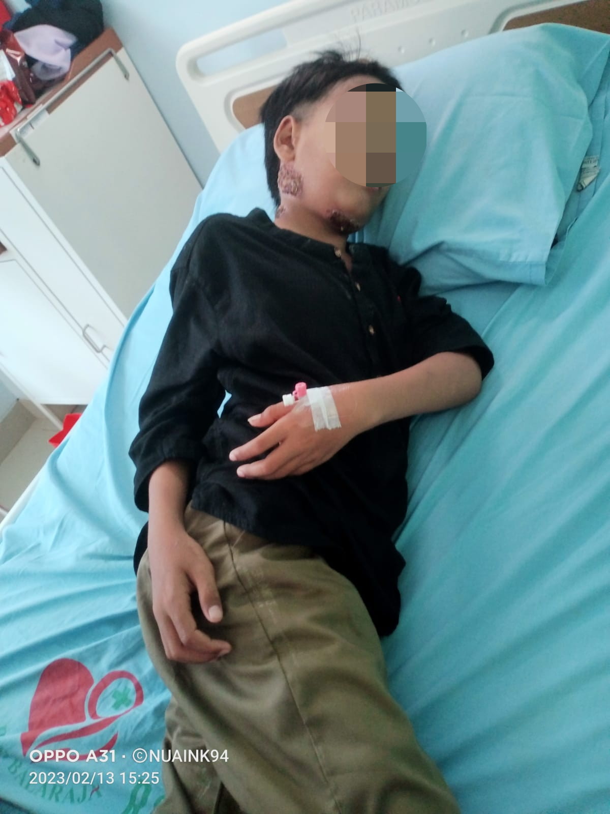 Anak Yatim ,Menderita Penyakit Kanker Kulit Butuh Bantuan Warga Desa Cangkudu Kec. Balaraja