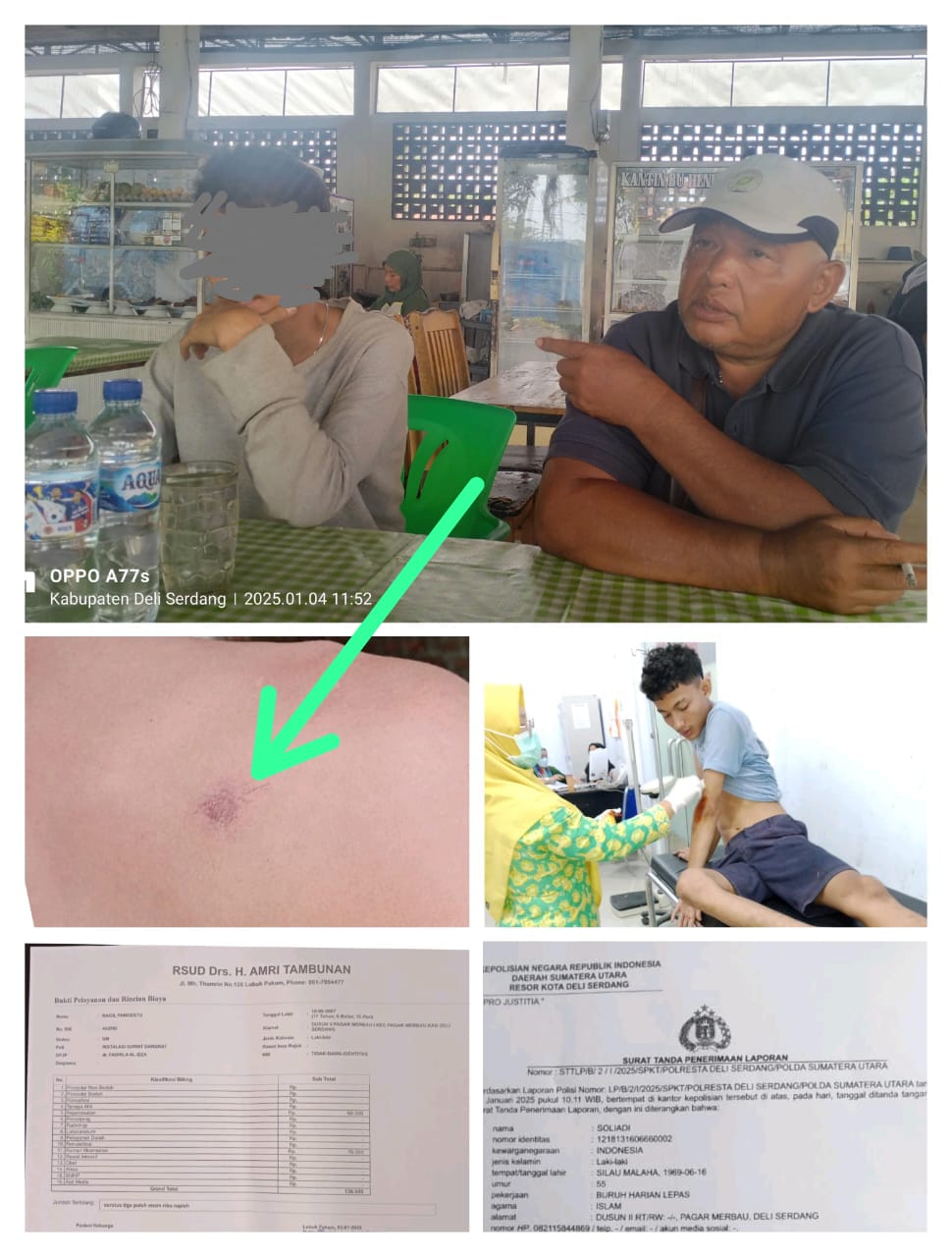 Ragil Pangestu Anak Seorang Wartawan Media Online Sumut Dianiaya Inisial “MAK”