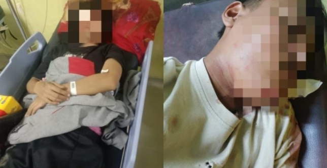 Mengaku Dipukul Oknum Polisi, Usai Insiden Kecelakaan