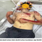 Sadis…! Demi Klaim Asuransi Jiwa Diduga Juwita “Rekayasa Kematian Saudaranya”