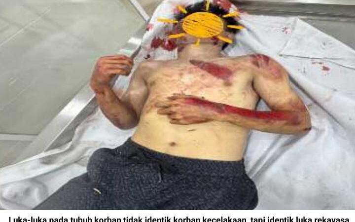 Sadis…! Demi Klaim Asuransi Jiwa Diduga Juwita “Rekayasa Kematian Saudaranya”