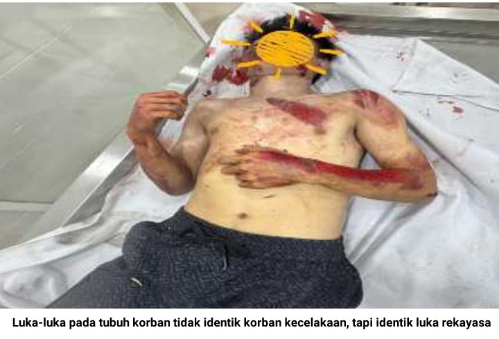 Sadis…! Demi Klaim Asuransi Jiwa Diduga Juwita “Rekayasa Kematian Saudaranya”