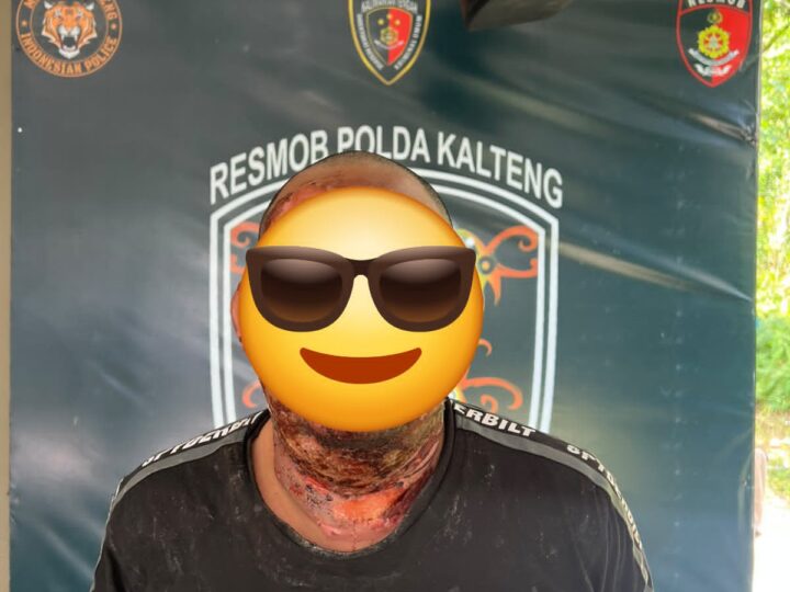 Diduga Cemburu, Pria di Kotim Tega Bakar Teman Wanitanya
