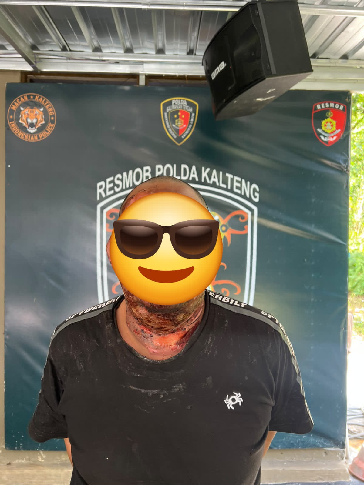 Diduga Cemburu, Pria di Kotim Tega Bakar Teman Wanitanya