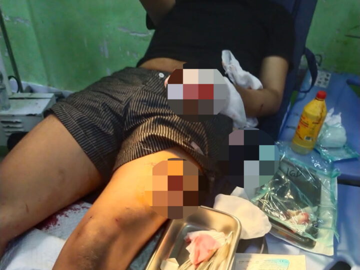 Diduga Menjadi Korban Kekerasan Bersenjata Tajam, Anak Jurnalis di Cirebon Belum Peroleh Kepastian Hukum
