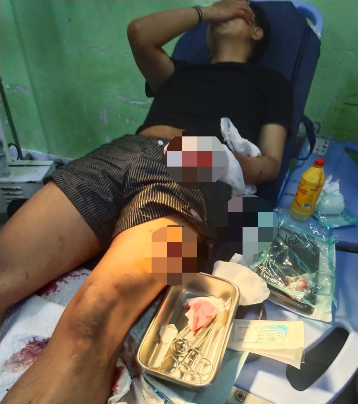 Diduga Menjadi Korban Kekerasan Bersenjata Tajam, Anak Jurnalis di Cirebon Belum Peroleh Kepastian Hukum